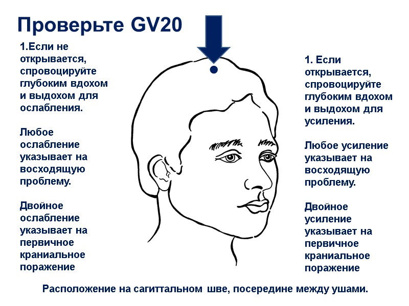 Проверьте GV20 Расположение на сагиттальном шве, посередине между ушами. ● 1.Если не открывается, спровоцируйте